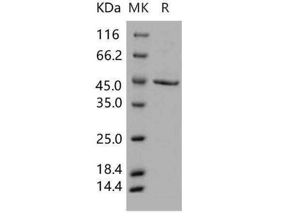 Human SERPINB1/PI2 Recombinant Protein (RPES4862)