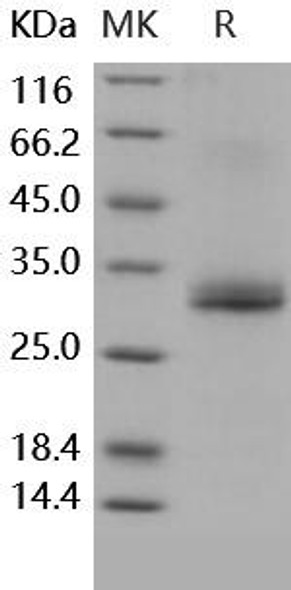 Human Noggin/NOG Recombinant Protein (RPES4863)