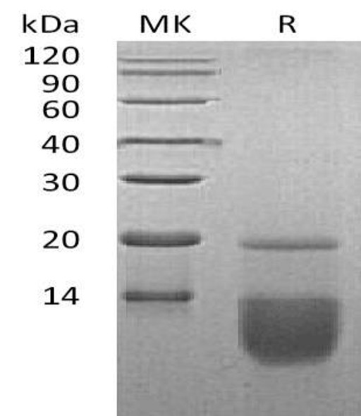 Human CCL3 Recombinant Protein (RPES4884)