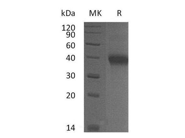 Mouse OX40/TNFRSF4 Recombinant Protein (RPES4912)