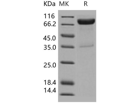 Human IL10RB/IL10R2 Recombinant Protein (RPES4917)