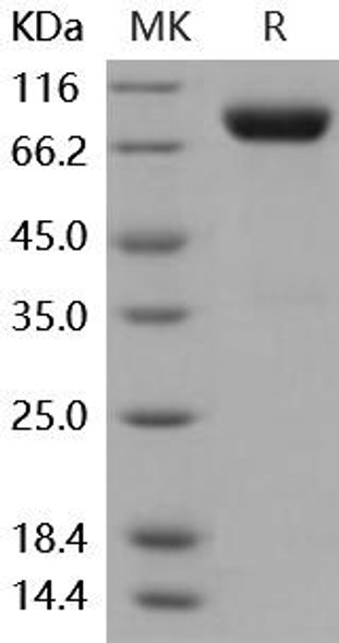 Mouse IL2RG/CD132 Recombinant Protein (RPES4921)