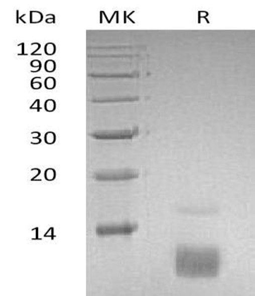 Human CCL5/RANTES Recombinant Protein (RPES4924)