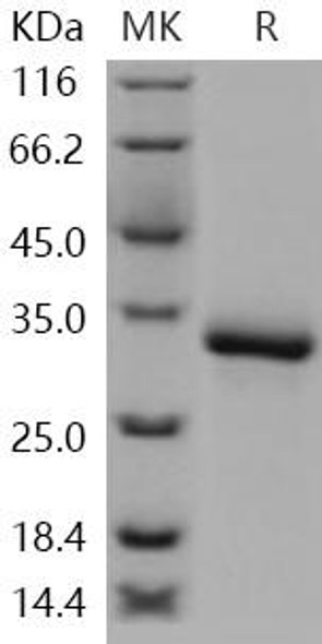 Human XEDAR/EDA2R Recombinant Protein (RPES4937)