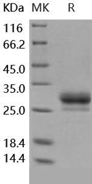 Human CD32b/FCGR2B Recombinant Protein (RPES4943)