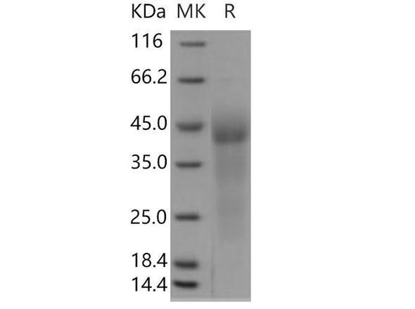 Human GPR37 Recombinant Protein (RPES4956)
