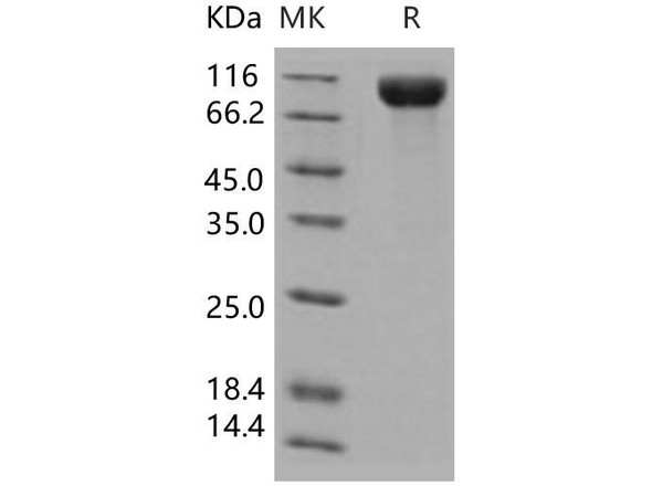 Human IL13RA1 Recombinant Protein (RPES4958)