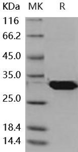 Mouse Latexin/LXN Recombinant Protein (RPES5004)