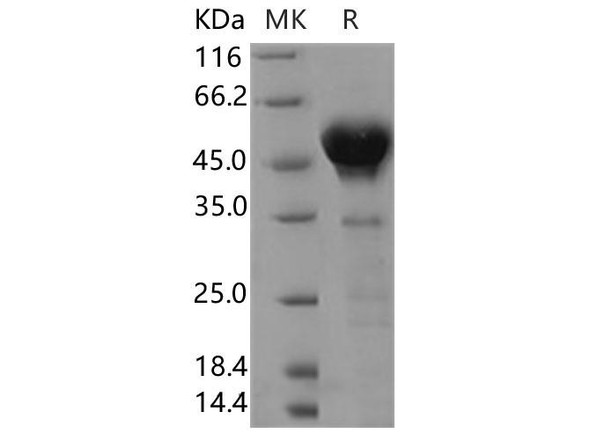 Human Calumenin Recombinant Protein (RPES5017)