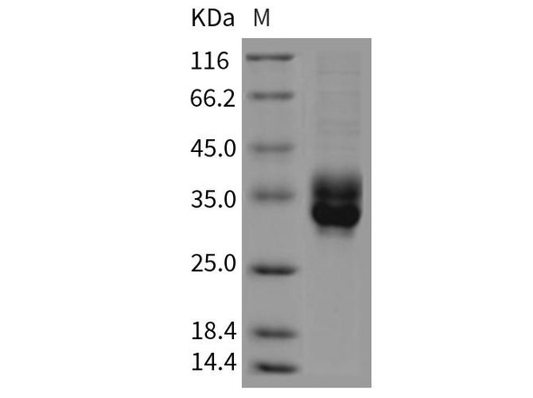 Rat CLEC4B2/mDCAR1 Recombinant Protein (RPES5021)