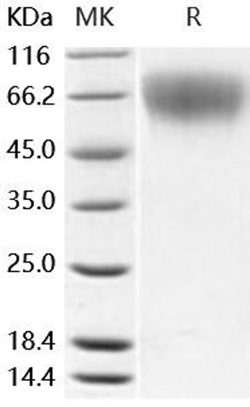 Mouse L-Selectin/SELL Recombinant Protein (RPES5023)