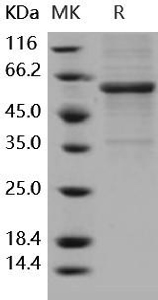 Human METAP1 Recombinant Protein (RPES5025)