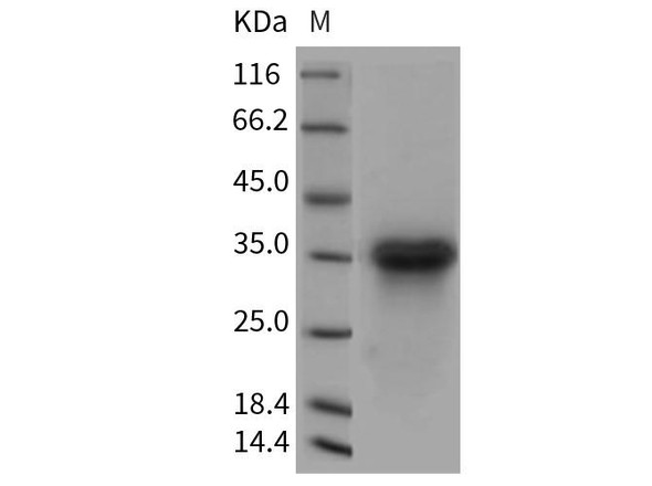 Rat LTBR/TNFRSF3 Recombinant Protein (RPES5030)