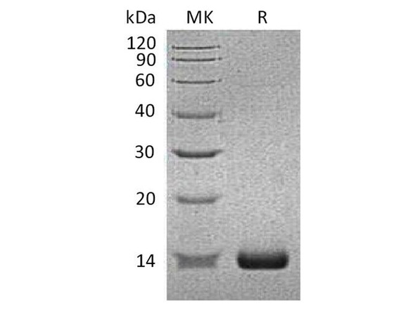 Human SAA2/Serum Amyloid A2 Recombinant Protein (RPES5036)