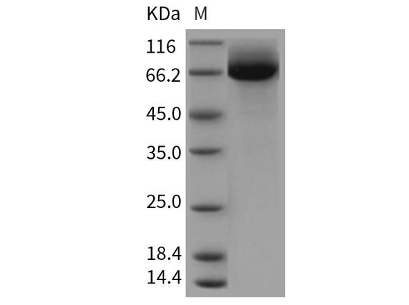 Rat CD36/SCARB3 Recombinant Protein (RPES5041)