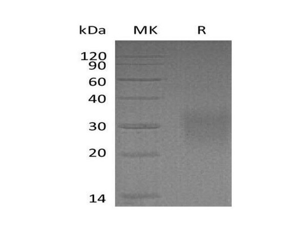 Mouse CD83/HB15 Recombinant Protein (RPES5053)