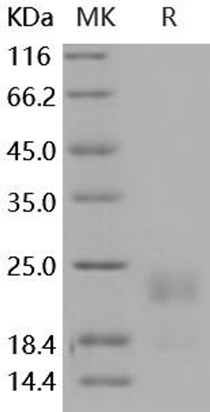 Mouse HAI-2/SPINT2 Recombinant Protein (RPES5082)