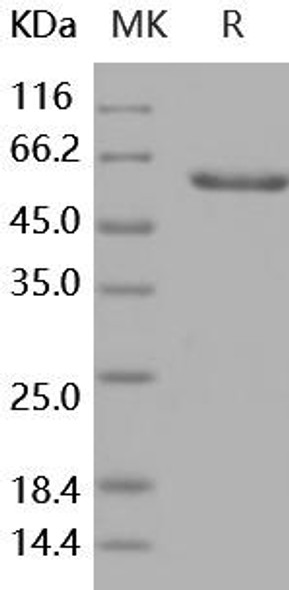 Human Layilin/LAYN Recombinant Protein (RPES5084)