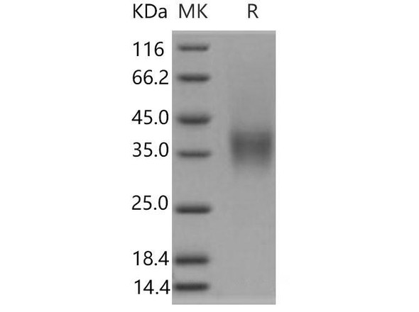 Mouse CD16-2/FCGR4 Recombinant Protein (RPES5101)