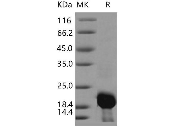 Human Calmodulin 2/CALM2 Recombinant Protein (RPES5102)