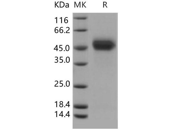 Human uPAR Recombinant Protein (RPES5117)