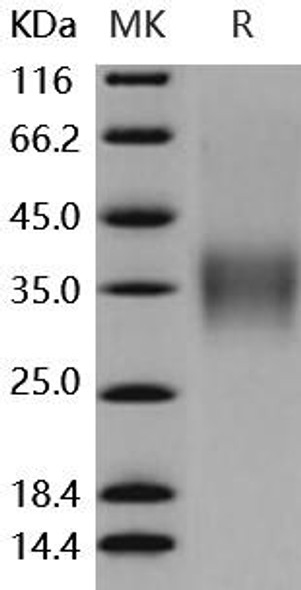 Mouse CD16-2/FCGR4 Recombinant Protein (RPES5121)