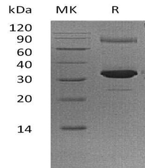 Human GNMT Recombinant Protein (RPES5125)