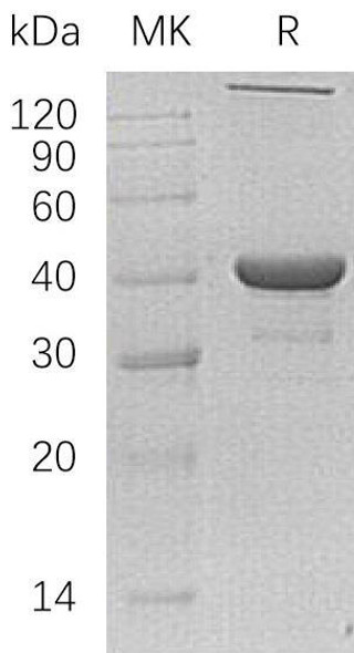 Human NANS/SAS Recombinant Protein (RPES5126)