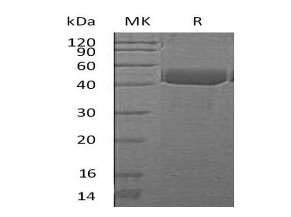 Mouse Cathepsin E/CTSE Recombinant Protein (RPES5132)