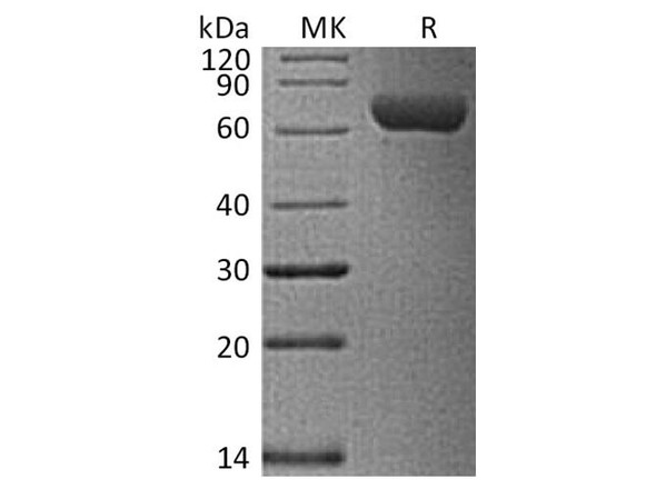 Human ROR1 Recombinant Protein (RPES5134)
