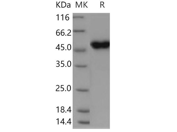 Human CRELD1 Recombinant Protein (RPES5135)