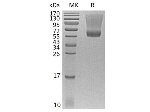 Human Renin Recombinant Protein (RPES5191)