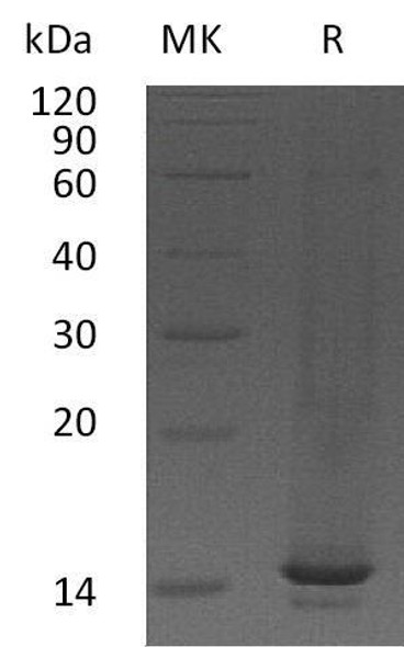 Mouse CCL9/MIP-Beta Recombinant Protein (RPES5207)