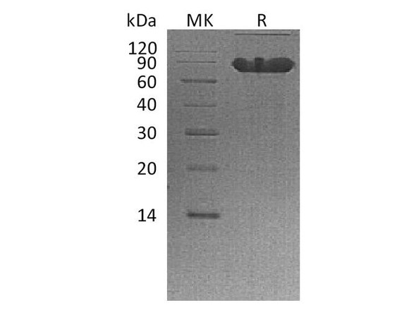 Human CD44 Recombinant Protein (RPES5223)