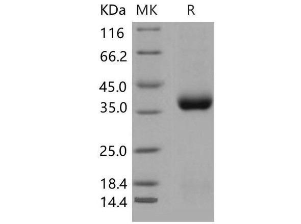 Mouse CLEC10A/CD301 Recombinant Protein (RPES5241)