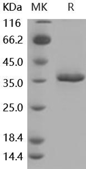 Mouse sFRP2 Recombinant Protein (RPES5242)