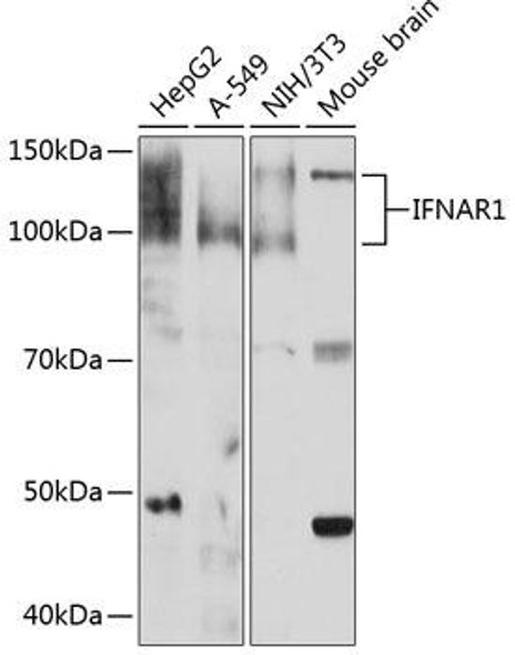 Cell Biology Antibodies 16 Anti-IFNAR1 Antibody CAB0575