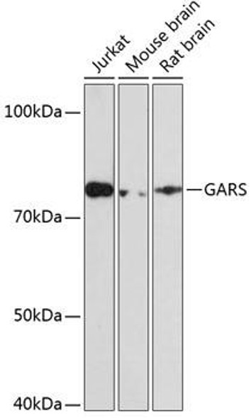 Metabolism Antibodies 3 Anti-GARS Antibody CAB0651