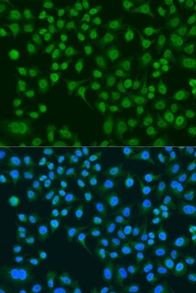 Cell Biology Antibodies 16 Anti-LRRK2 Antibody CAB0859