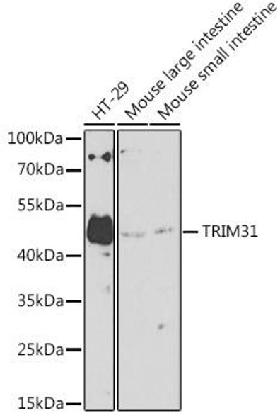 Cell Biology Antibodies 16 Anti-TRIM31 Antibody CAB10639