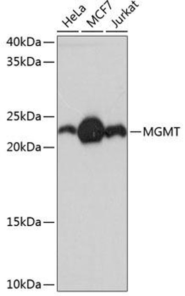 Epigenetics and Nuclear Signaling Antibodies 5 Anti-MGMT Antibody CAB11151