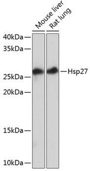 Immunology Antibodies 3 Anti-Hsp27 Antibody CAB11156