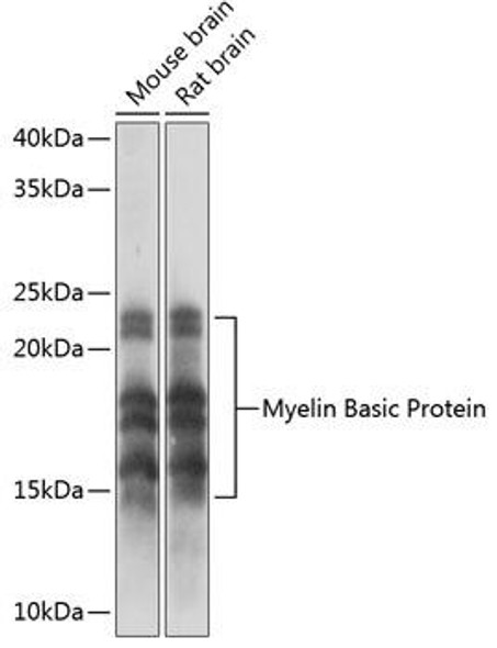 Cell Biology Antibodies 16 Anti-Myelin Basic Protein Antibody CAB11162