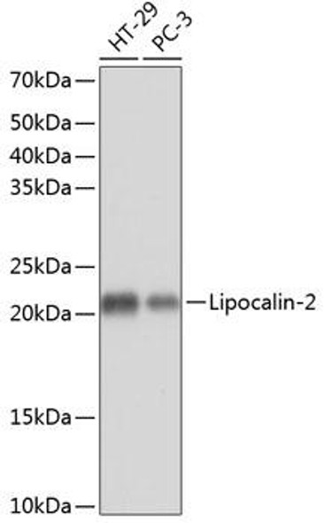 Cell Death Antibodies 2 Anti-Lipocalin-2 Antibody CAB11207