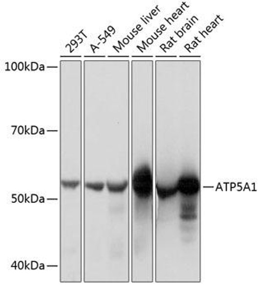 Metabolism Antibodies 3 Anti-ATP5A1 Antibody CAB11217