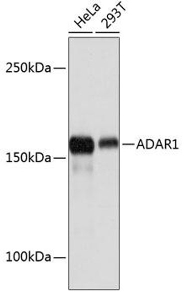 Immunology Antibodies 3 Anti-ADAR1 Antibody CAB11466