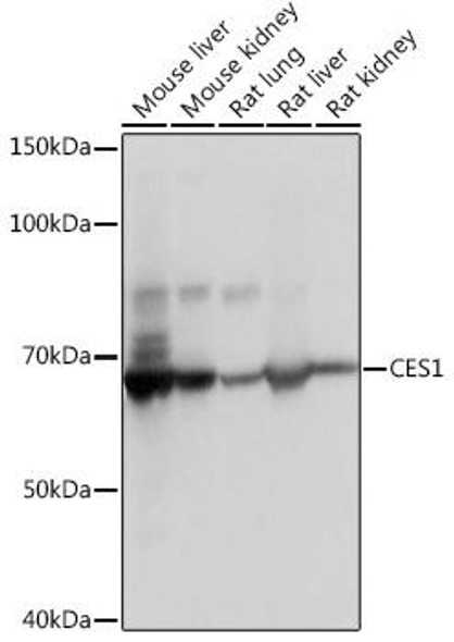 Cell Biology Antibodies 16 Anti-CES1 Antibody CAB11478