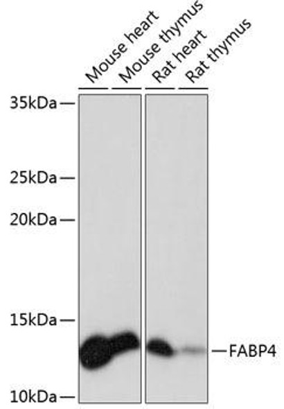 Signal Transduction Antibodies 3 Anti-FABP4 Antibody CAB11481