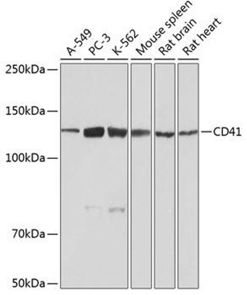 Cell Biology Antibodies 16 Anti-CD41 Antibody CAB11490