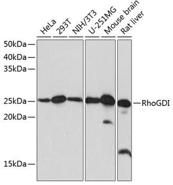 KO Validated Antibodies 1 Anti-RhoGDIKO Validated Antibody CAB11556